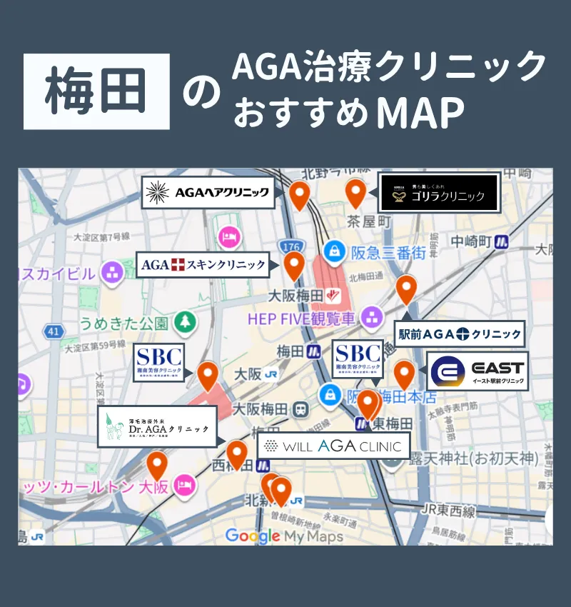 大阪梅田駅周辺のAGA治療おすすめクリニック分布